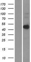 CerS6 / LASS6 Protein - Western validation with an anti-DDK antibody * L: Control HEK293 lysate R: Over-expression lysate