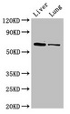 Ces1c / Carboxylesterase 1C Antibody - Western Blot Positive WB detected in: Mouse liver tissue, Rat lung tissue All lanes: Ces1c antibody at 5µg/ml Secondary Goat polyclonal to rabbit IgG at 1/50000 dilution Predicted band size: 62 kDa Observed band size: 62 kDa