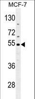 CES2 / Esterase Antibody - CES2 Antibody western blot of MCF-7 cell line lysates (35 ug/lane). The CES2 antibody detected the CES2 protein (arrow).