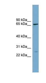CES2 / Esterase Antibody - CES2 / Esterase antibody Western blot of THP-1 cell lysate. This image was taken for the unconjugated form of this product. Other forms have not been tested.