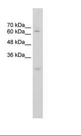 CES2 / Esterase Antibody - HepG2 Cell Lysate.  This image was taken for the unconjugated form of this product. Other forms have not been tested.