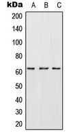 CES2 / Esterase Antibody - Western blot analysis of CES2 expression in HepG2 (A); SP2/0 (B); H9C2 (C) whole cell lysates.