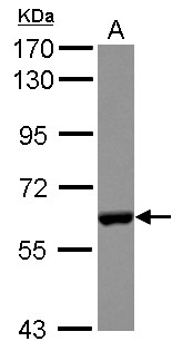 CES2 / Esterase Antibody - Sample (30 ug of whole cell lysate) A: HepG2 7.5% SDS PAGE CES2 / Esterase antibody diluted at 1:2000