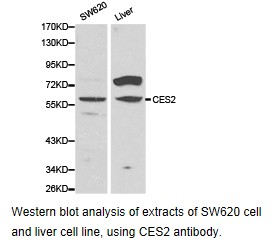 CES2 / Esterase Antibody - Western blot.