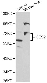CES2 / Esterase Antibody - Western blot analysis of extracts of various cell lines, using CES2 antibody at 1:1000 dilution. The secondary antibody used was an HRP Goat Anti-Rabbit IgG (H+L) at 1:10000 dilution. Lysates were loaded 25ug per lane and 3% nonfat dry milk in TBST was used for blocking.