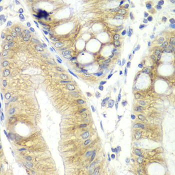 CES2 / Esterase Antibody - Immunohistochemistry of paraffin-embedded human colon using CES2 antibodyat dilution of 1:100 (40x lens).
