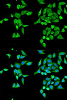 CES2 / Esterase Antibody - Immunofluorescence analysis of MCF-7 cells using CES2 antibody. Blue: DAPI for nuclear staining.