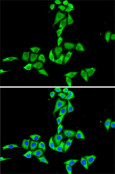 CES2 / Esterase Antibody - Immunofluorescence analysis of HeLa cells using CES2 antibody. Blue: DAPI for nuclear staining.