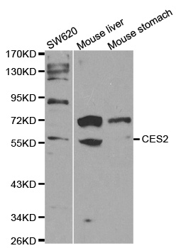 CES2 / Esterase Antibody - Western blot analysis of extracts of various cell lines, using CES2 antibody at 1:1000 dilution. The secondary antibody used was an HRP Goat Anti-Rabbit IgG (H+L) at 1:10000 dilution. Lysates were loaded 25ug per lane and 3% nonfat dry milk in TBST was used for blocking.