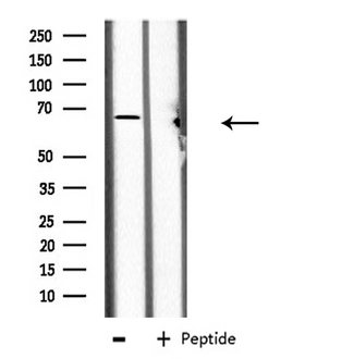 CES2 / Esterase Antibody - Western blot analysis of extracts of Jurkat cells using CES2 antibody.