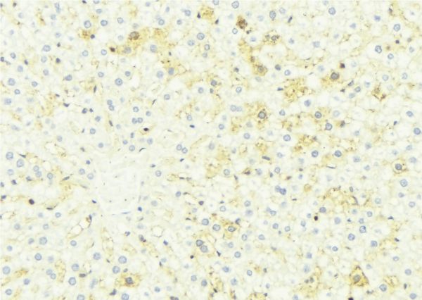 CES2 / Esterase Antibody - 1:100 staining mouse liver tissue by IHC-P. The sample was formaldehyde fixed and a heat mediated antigen retrieval step in citrate buffer was performed. The sample was then blocked and incubated with the antibody for 1.5 hours at 22°C. An HRP conjugated goat anti-rabbit antibody was used as the secondary.