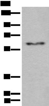 CES2 / Esterase Antibody - Western blot analysis of Human fetal liver tissue lysate  using CES2 Polyclonal Antibody at dilution of 1:600