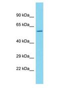 CES4A Antibody - CES4A antibody Western Blot of PANC1. Antibody dilution: 1 ug/ml.  This image was taken for the unconjugated form of this product. Other forms have not been tested.