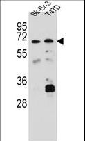 CES4A Antibody - CES8 Antibody western blot of Sk-Br-3,T47D cell line lysates (35 ug/lane). The CES8 antibody detected the CES8 protein (arrow).