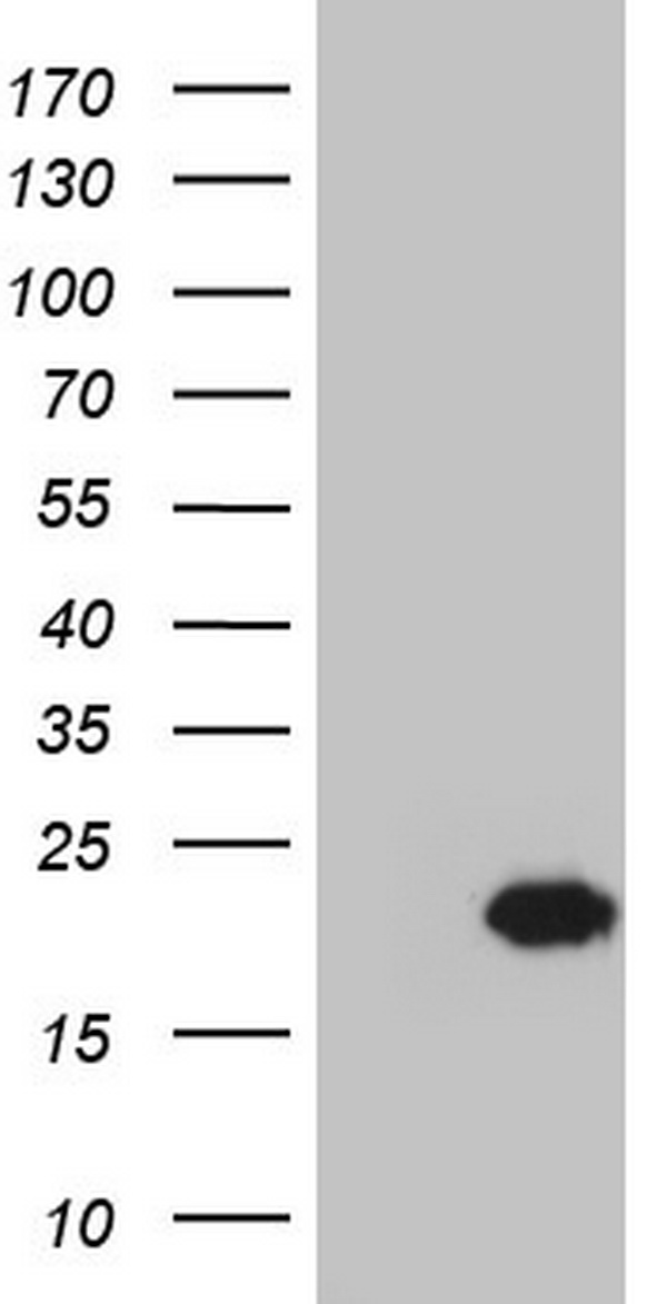 CETN1 Antibody - HEK293T cells were transfected with the pCMV6-ENTRY control (Left lane) or pCMV6-ENTRY CETN1 (Right lane) cDNA for 48 hrs and lysed. Equivalent amounts of cell lysates (5 ug per lane) were separated by SDS-PAGE and immunoblotted with anti-CETN1.