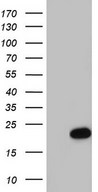 CETN1 Antibody - HEK293T cells were transfected with the pCMV6-ENTRY control. (Left lane) or pCMV6-ENTRY CETN1. (Right lane) cDNA for 48 hrs and lysed. Equivalent amounts of cell lysates. (5 ug per lane) were separated by SDS-PAGE and immunoblotted with anti-CETN1.