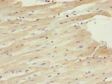 CETN1 Antibody - Immunohistochemistry of paraffin-embedded human heart tissue at dilution of 1:100