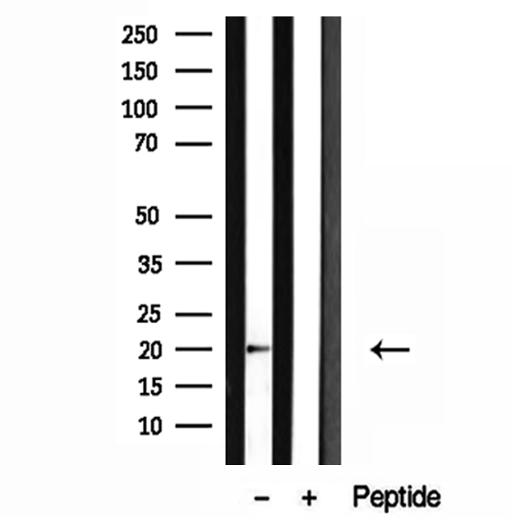 CETN1 Antibody - Western blot analysis of extracts of HL-60 cells using Centrin 1 antibody.