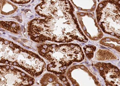 CETN1 Antibody - 1:100 staining human kidney tissue by IHC-P. The sample was formaldehyde fixed and a heat mediated antigen retrieval step in citrate buffer was performed. The sample was then blocked and incubated with the antibody for 1.5 hours at 22°C. An HRP conjugated goat anti-rabbit antibody was used as the secondary.