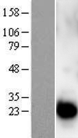 CETN1 Protein - Western validation with an anti-DDK antibody * L: Control HEK293 lysate R: Over-expression lysate