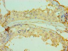 CETN2 / Centrin 2 Antibody - Immunohistochemistry of paraffin-embedded human testicle using antibody at 1:100 dilution.