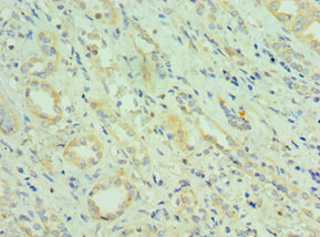 CETN2 / Centrin 2 Antibody - Immunohistochemistry of paraffin-embedded human kidney tissue using CETN2 Antibody at dilution of 1:100