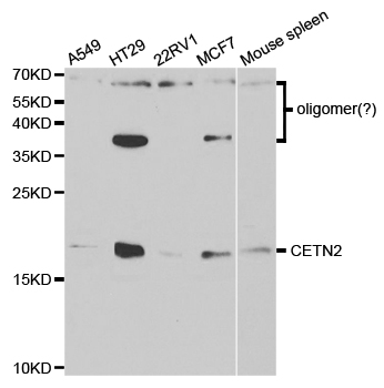 CETN2 / Centrin 2 Antibody - Western blot analysis of extracts of various cell lines.