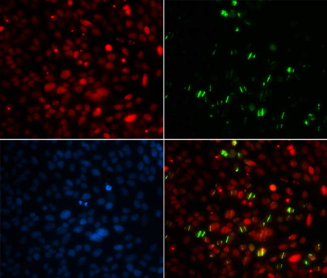 CETN2 / Centrin 2 Antibody - Immunofluorescence analysis of MCF7 cells.
