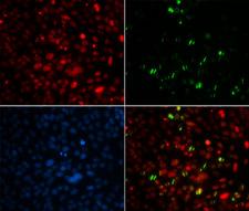 CETN2 / Centrin 2 Antibody - Immunofluorescence analysis of MCF7 cells.