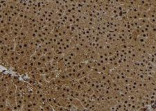 CETN2 / Centrin 2 Antibody - 1:100 staining rat liver tissue by IHC-P. The sample was formaldehyde fixed and a heat mediated antigen retrieval step in citrate buffer was performed. The sample was then blocked and incubated with the antibody for 1.5 hours at 22°C. An HRP conjugated goat anti-rabbit antibody was used as the secondary.