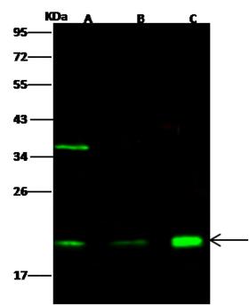CETN2 / Centrin 2 Antibody - Anti-CETN2 rabbit polyclonal antibody at 1:500 dilution. Lane A: A549 Whole Cell Lysate. Lane B: HT29 Whole Cell Lysate. Lane C: MCF7 Whole Cell Lysate. Lysates/proteins at 30 ug per lane. Secondary: Goat Anti-Rabbit IgG H&L (Dylight 800) at 1/10000 dilution. Developed using the Odyssey technique. Performed under reducing conditions. Predicted band size: 20 kDa. Observed band size: 20 kDa. (We are unsure as to the identity of these extra bands.)