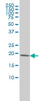 CETN3 Antibody - CETN3 monoclonal antibody (M01), clone 3E6 Western Blot analysis of CETN3 expression in Jurkat.