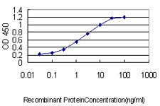 CETN3 Antibody - Detection limit for recombinant GST tagged CETN3 is approximately 0.1 ng/ml as a capture antibody.