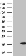 CETN3 Antibody - HEK293T cells were transfected with the pCMV6-ENTRY control (Left lane) or pCMV6-ENTRY CETN3 (Right lane) cDNA for 48 hrs and lysed. Equivalent amounts of cell lysates (5 ug per lane) were separated by SDS-PAGE and immunoblotted with anti-CETN3.