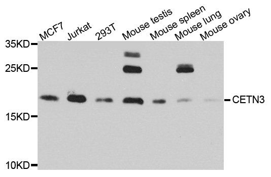 CETN3 Antibody - Western blot analysis of extract of various cells.