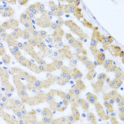 CETN3 Antibody - Immunohistochemistry of paraffin-embedded human liver injury tissue.