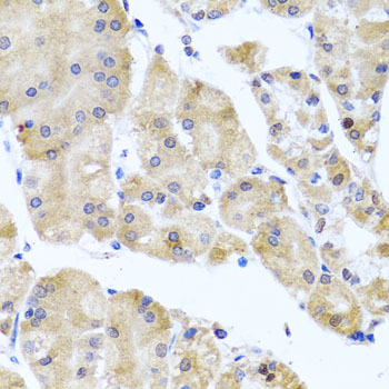 CETN3 Antibody - Immunohistochemistry of paraffin-embedded human stomach tissue.
