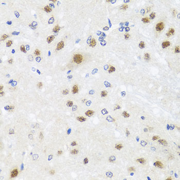 CETN3 Antibody - Immunohistochemistry of paraffin-embedded rat brain tissue.