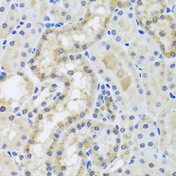 CETN3 Antibody - Immunohistochemistry of paraffin-embedded mouse kidney tissue.