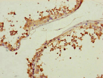 CETN3 Antibody - Immunohistochemistry of paraffin-embedded human testis tissue at dilution of 1:100