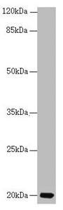 CETN3 Antibody - Western blot All Lanes:CETN3 antibody at 1.77 ug/ml+ Mouse gonadal tissue Secondary Goat polyclonal to rabbit IgG at 1/10000 dilution Predicted band size: 20 kDa Observed band size: 20 kDa