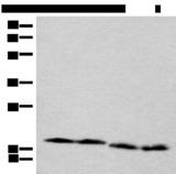 CETN3 Antibody - Western blot analysis of TM4 Jurkat NIH/3T3 and RAW264.7 cell lysates  using CETN3 Polyclonal Antibody at dilution of 1:600