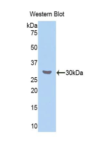 CETP Antibody - Western blot of recombinant CETP.  This image was taken for the unconjugated form of this product. Other forms have not been tested.