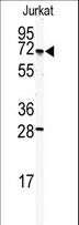 CETP Antibody - Western blot of anti-CETP Antibody in Jurkat cell line lysates (35 ug/lane). CETP (arrow) was detected using the purified antibody.