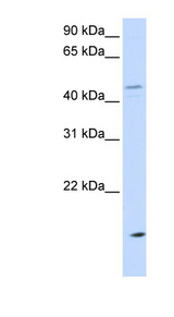 CETP Antibody - CETP antibody Western blot of MCF7 cell lysate. This image was taken for the unconjugated form of this product. Other forms have not been tested.