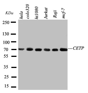 CETP Antibody - WB of CETP antibody. Lane 1: HELA Cell Lysate. Lane 2: COLO320 Cell Lysate. Lane 3: HT1080 Cell Lysate. Lane 4: JURKAT Cell Lysate. Lane 5: RAJI Cell Lysate. Lane 6: MCF-7 Cell Lysate.