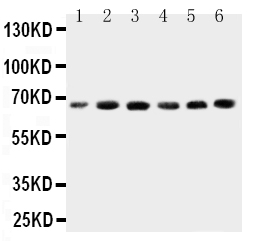 CETP Antibody - Anti-CETP antibody, Western blotting Lane 1: HELA Cell LysateLane 2: COLO320 Cell LysateLane 3: HT1080 Cell LysateLane 4: JURKAT Cell LysateLane 5: RAJI Cell LysateLane 6: MCF-7 Cell Lysate