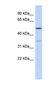 CETP Antibody - CETP antibody Western blot of Fetal Thymus lysate. This image was taken for the unconjugated form of this product. Other forms have not been tested.