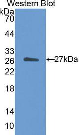 CETP Antibody - Western Blot; Sample: Recombinant protein.