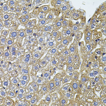 CETP Antibody - Immunohistochemistry of paraffin-embedded mouse liver using CETP antibody(40x lens).